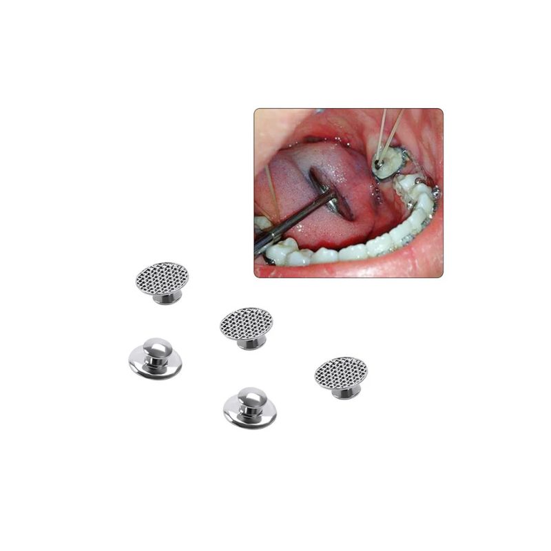 50 Bottoni Linguali Ortodontici AZDENT Base Rotonda, Acciaio Inox Per Dentisti